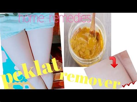 Home Remedies Pantanggal Ng Peklat .
